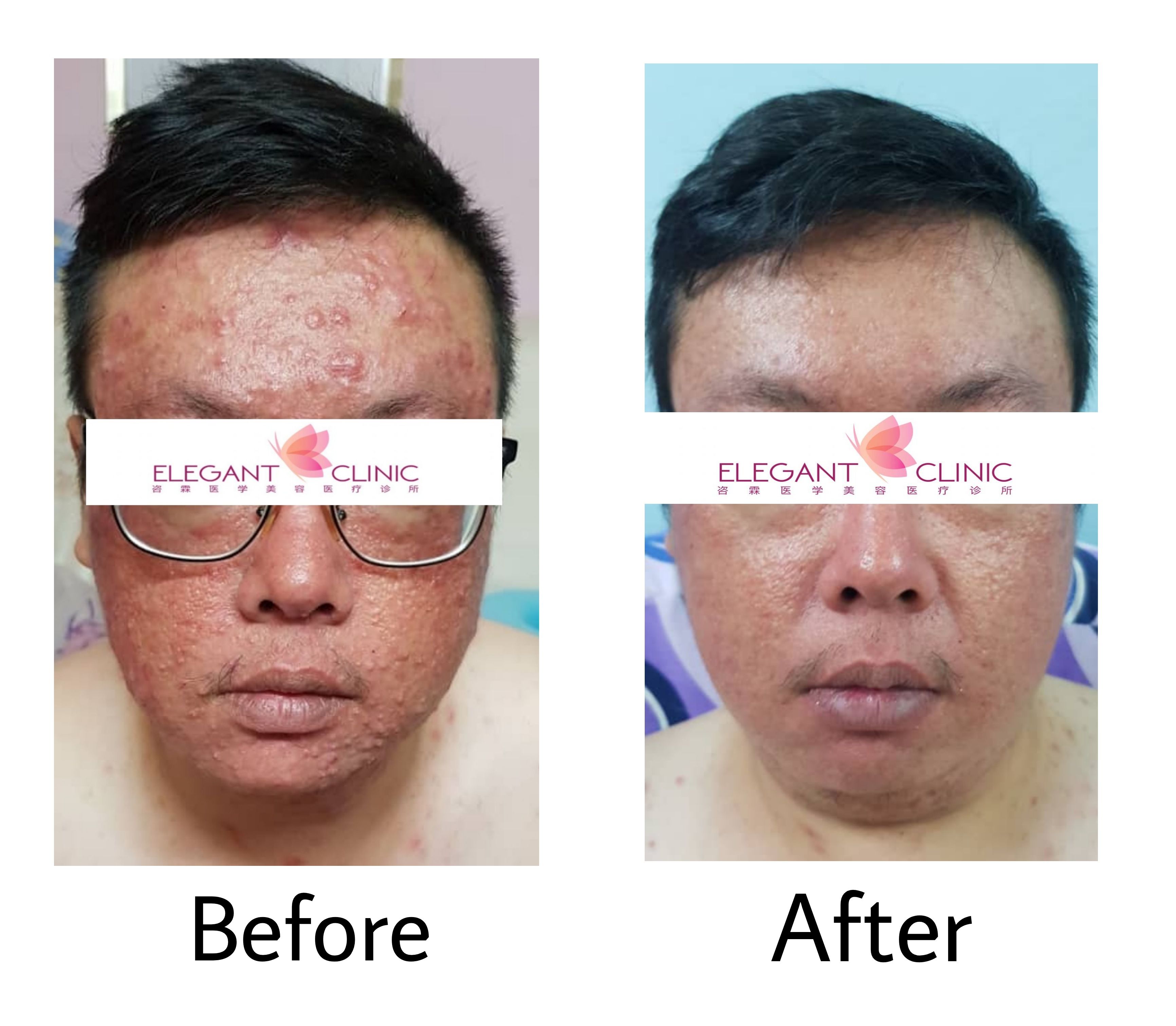 Article | Elegant Clinic