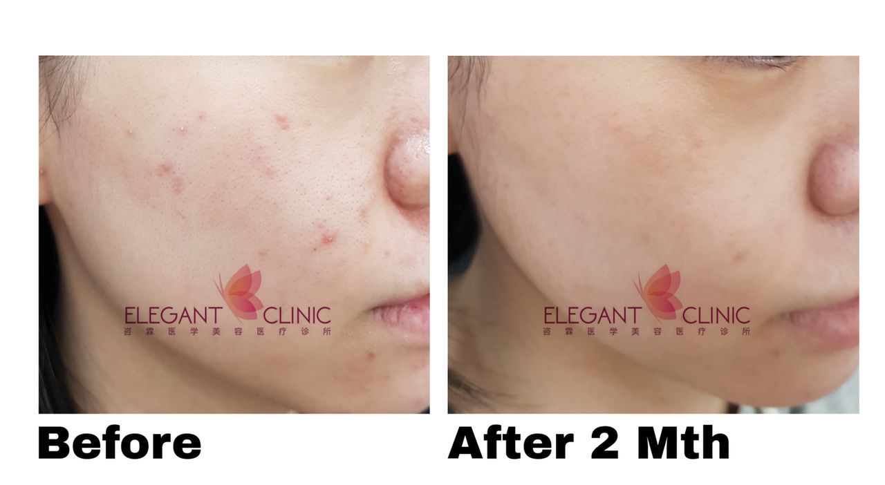 Article | Elegant Clinic